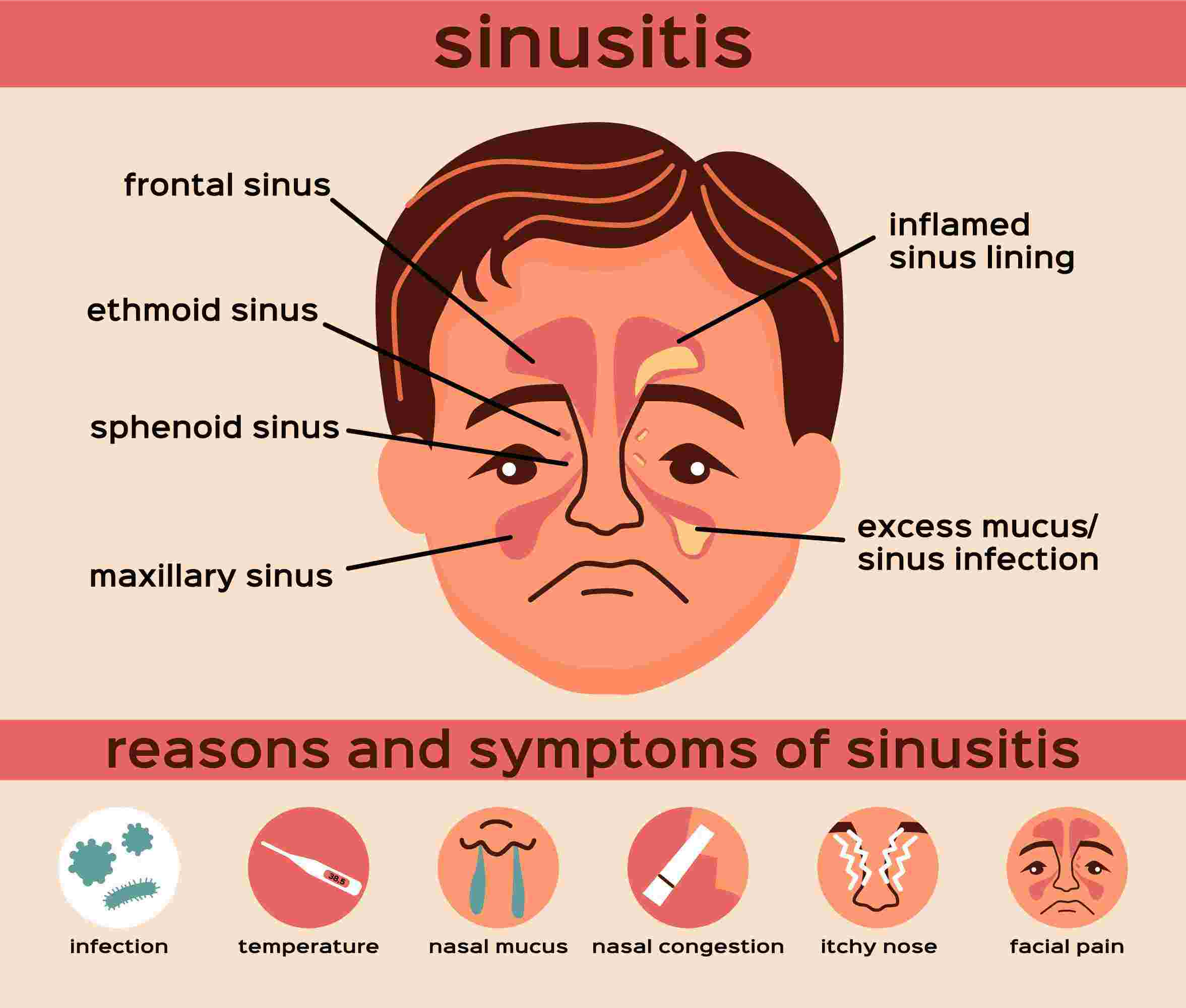 sinus